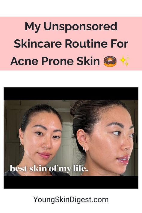 My Unsponsored Skincare Routine For Acne Prone Skin 🍩✨ Skincare Routine For Dry Sensitive Acne Prone Skin, Routine For Acne Prone Skin, Skincare Routine For Acne, Dry Acne Prone Skin, Natural Skincare Routine, Sensitive Acne Prone Skin, Acne Free Skin, Drugstore Skincare, Skin Care Order