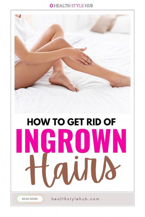 Bumps On Legs, Get Rid Of Ingrown Hairs, Treat Ingrown Hair, Ingrown Hair Remedies, Shaving Tips, Prevent Ingrown Hairs, Ingrown Hairs, Thick Skin, Natural Pain Relief