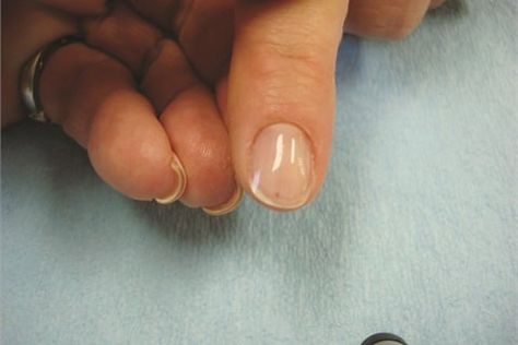 Return of the Nail Wrap - Technique - NAILS Magazine Wrap Nails, Shorter Nails, Nail Remedies, Fiberglass Nails, Silk Wrap Nails, Nail Coat, Weak Nails, Nails Trend, How To Wrap