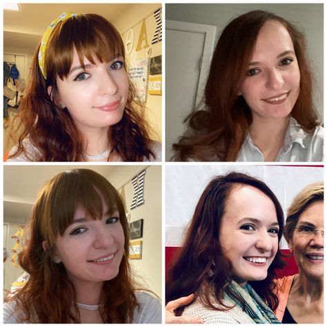 Recently bought some fake bangs on amazon to hide my big forehead. Opinions? Bangs or no bangs? #hair #hairstyle #hairstyles #beauty Hide Big Forehead, Bangs To Hide Big Forehead, Big Forehead Bangs Before And After, Before And After Bangs, Bangs For Big Forehead, Bangs Vs No Bangs, Big Forehead Hairstyles, Fake Bangs, Anna Hair