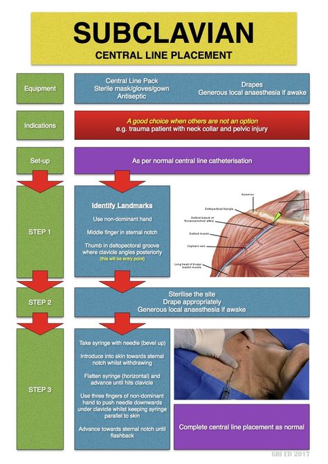 Subclavian Vein, Medical School Studying, Nursing Study, Medical School, Ultrasound, Saving Lives, Riddles, Anatomy, Nursing