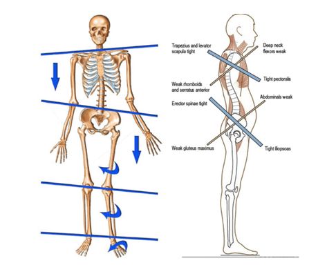 Decompress Spine, Spine Decompression, Pelvic Tilt, Sciatic Nerve Pain, Sciatic Nerve, Thai Massage, Lower Back Pain, Deep Tissue Massage, Nerve Pain