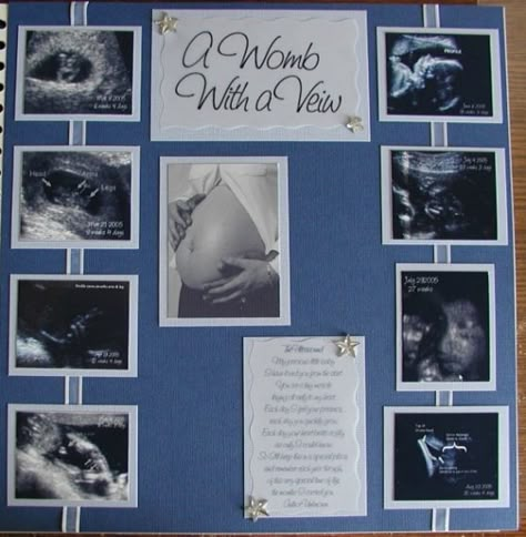 Ultrasound Pictures Scrapbook, Sonogram Scrapbook Page Ideas, Ultrasound Scrapbook Ideas, Maternity Scrapbook Ideas, Baby Scrapbook Pages Layouts, Sonogram Picture Ideas Display, Scrapbook Ideas For Baby Boy, Baby Scrapbook Page Ideas, Pregnancy Scrapbook Pages