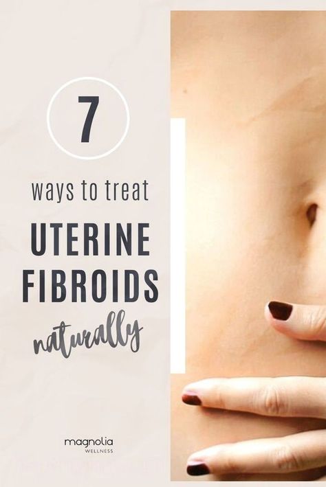 101 guide to fibroid tumors of the uterus | Magnolia Wellness OC Uterine Fibroid Remedies, Food That Shrink Fibroid, How To Get Rid Of Fibroid Tumors, Best Herbs For Fibroid, Fibroid Symptoms Signs, Essential Oils For Fibroid Tumors, Herbs For Uterus Health, Shrink Fibroid Fast, How To Get Rid Of Fibroid Naturally