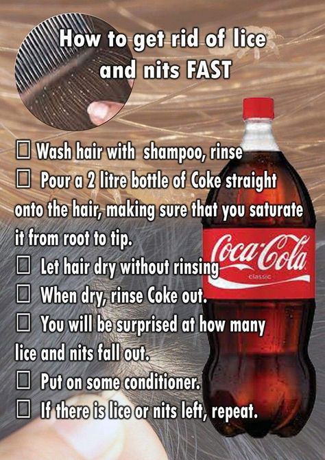 Despite claims that Coca-Cola is an effective solution for eliminating head lice, the evidence that it actually works isn't compelling. Lice Remedies, 1000 Lifehacks, Homemade Remedies, Simple Life Hacks, Natural Health Remedies, Diy Life Hacks, Washing Hair, Useful Life Hacks, Health Remedies