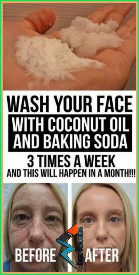 Increase flexibility and mobility. Baking Soda Face Wash, Baking Soda Coconut Oil, Coconut Oil Skin, Coconut Oil And Baking Soda, Baking Soda Face, Coconut Oil Skin Care, Coconut Oil Uses, Skin Care Wrinkles, Oil Skin