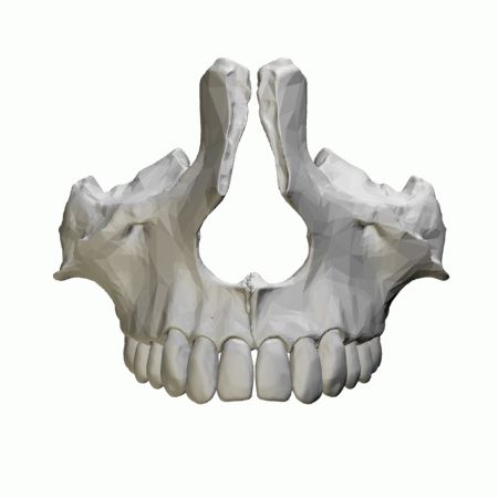 Maxillary_sinus_-_animation02.gif (450×450) Zygomatic Bone, Palatine Bone, Jaw Reduction Surgery, Bone Drawing, Maxillary Sinus, Cheek Implants, V Shape Face, Facial Bones, Craniosacral Therapy