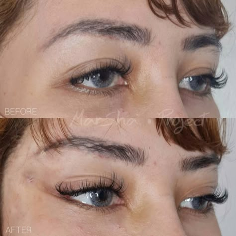 Fox Eye Surgery Before And After, Cat Eye Surgery, Upturned Almond Eyes, Eyes Surgery, Eye Lift Surgery, Face Plastic Surgery, Foxy Eyes, Natural Skin Tightening, Botox Cosmetic