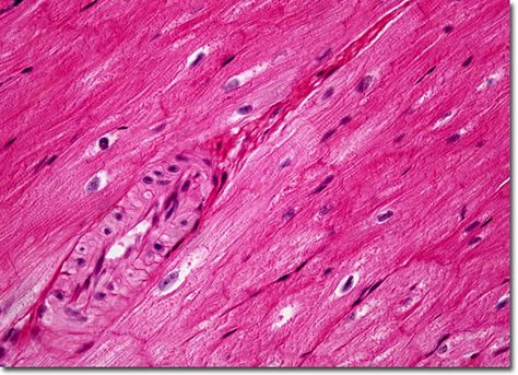 Cells Microscope, Smooth Muscle Tissue, Smooth Muscle, Under Microscope, Under A Microscope, Bio Art, Muscle Tissue, Study Materials, Body Art