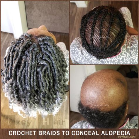 Alopecia Loc Hairstyles, Alopecia Crochet Hairstyles, Crochet Braids For Alopecia, Braids For Women With Alopecia, Alopecia Hairstyles Black Women Braids, Braids For Alopecia For Black Women, Braids With Alopecia, Braids For Alopecia, Alopecia Braid Styles