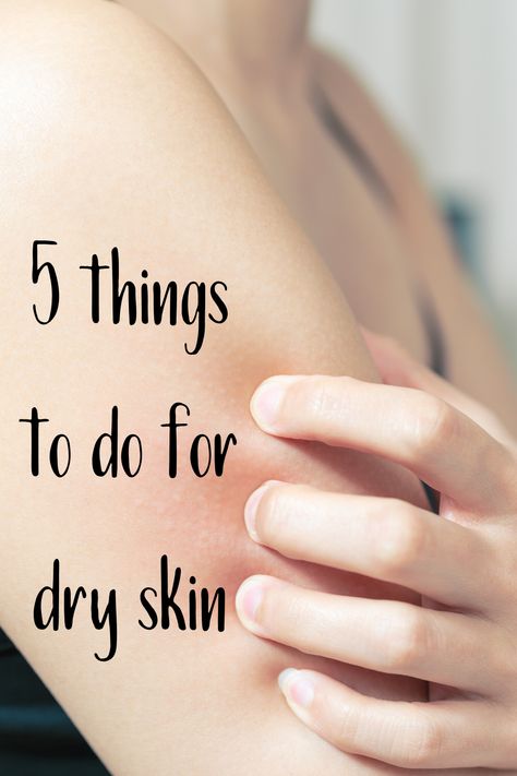 Get rid of dry skin with these five tips. Extra Dry Skin Remedies, How To Help Dry Skin, How To Get Rid Of Dry Skin, Remedies For Hives, Skin Body Care Routine, Home Remedies For Hives, Remedy For Dry Skin, Dry Skin Home Remedies, Get Rid Of Dry Skin