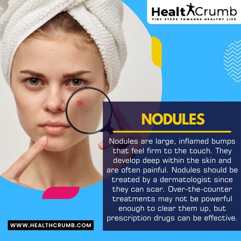 Nodules . . . . . #healthcrumb #health #skincare #acne #nodules #skinhacks #remedy #homeremedy #regime #routine #hacks #healthylifestyle Nodule Acne, Skincare Acne, Tiny Steps, Skin Tips, Home Remedies, Healthy Life, Healthy Lifestyle, Acne, Skin