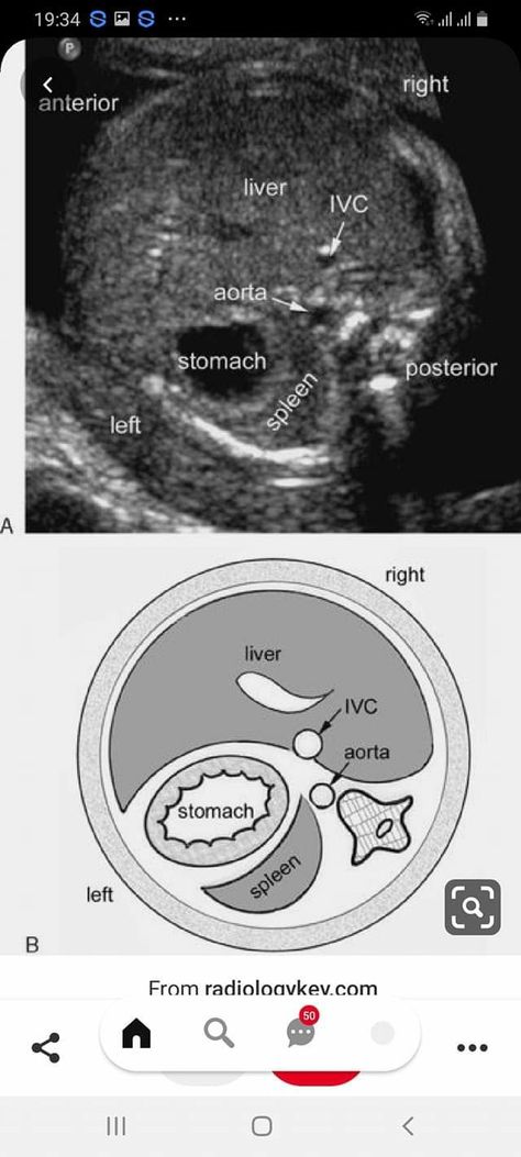 Ultrasound Student, Fetal Ultrasound, Diagnostic Medical Sonography Student, Ultrasound School, Ultrasound Physics, Obstetric Ultrasound, Cardiac Sonography, Radiologic Technology, Sonography Student