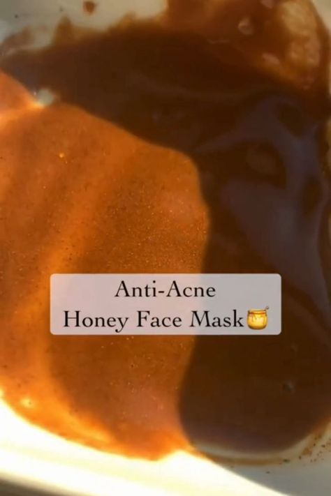 Face Pack To Remove Acne Marks, Face Pack For Acne Prone Skin, Gelatin Mask For Blackheads, Face Care Routine Clear Skin Acne Home Remedies, How To Get Rid Of A Pimple Under Skin, Oatmeal Face Mask For Acne, Face Pack For Acne Marks, Acne Free Skin Routine, Face Mask For Pimples Clear Skin