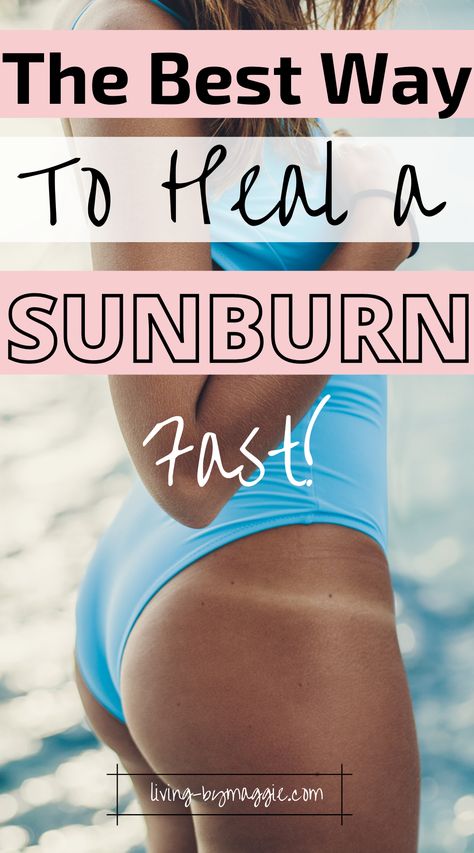 Essential Oil For Sunburn Relief, Bath For Sunburn Relief, What To Put On Sunburn Skin, Homemade Sunburn Relief, Remedies For Sunburn Skin, Diy Sunburn Remedies, How To Not Peel After Sunburn, What Helps With Sunburns, Sunburn Skin Peeling Remedies