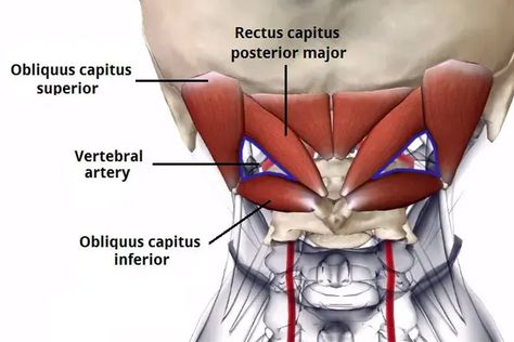 The Ultimate Guide to the Suboccipital Muscles - Iron Neck Suboccipital Muscles, Neck Muscle Anatomy, Anatomy Pictures, Severe Neck Pain, Whiplash Injury, Head Muscles, Vertebral Artery, Occipital Neuralgia, Muscle Stretches