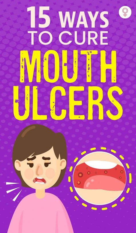 #OralDentalCare Ulcer Remedies Mouth, Remedies For Tooth Ache, Dental Cavities, Hygiene Care, Tooth Sensitivity, Stronger Teeth, Oral Care Routine, Gum Care, Oral Health Care