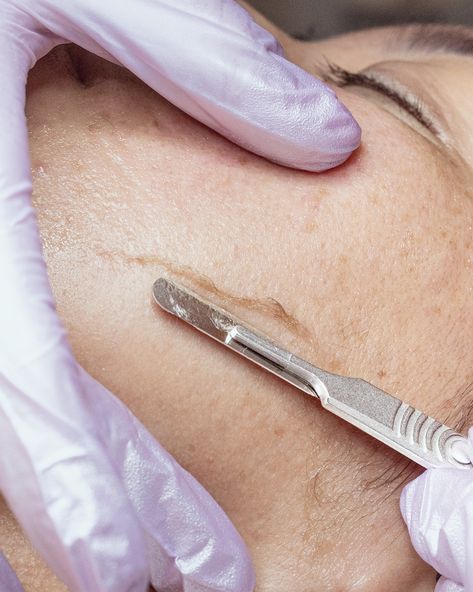 Smooth skin, sharp results - experience the brilliance of dermaplaning ✨️😍  #FacialNearMe #GlowingSkin #SkinHealth #JoannaVargas #HappyInYourSkin Dermaplane Facial, Dermaplaning Aesthetic, Dermaplaning Facial, Facial Esthetics, Joanna Vargas, Medical Aesthetician, Esthetician Inspiration, Skin Therapist, Aesthetic Clinic