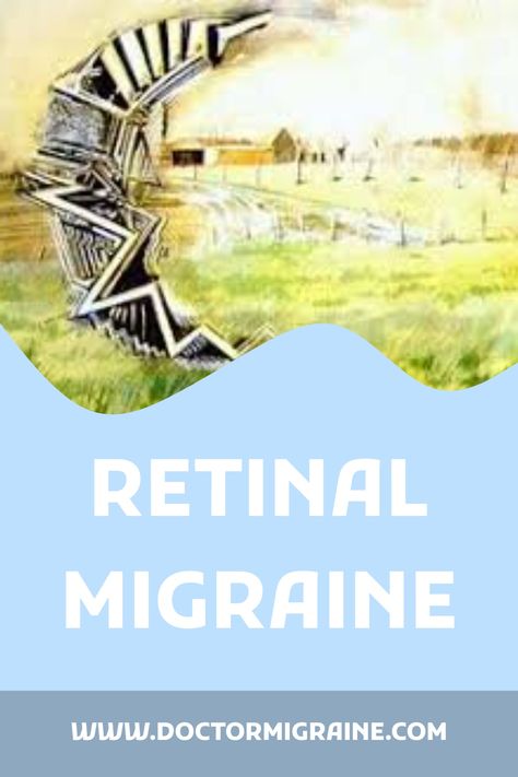 Migraine Aura Image, Ocular Migraines Eyes, Optical Migraine, Occular Migraine, Migraine Types, Visual Migraine, Botox Migraine, Kidney Anatomy, Types Of Migraines