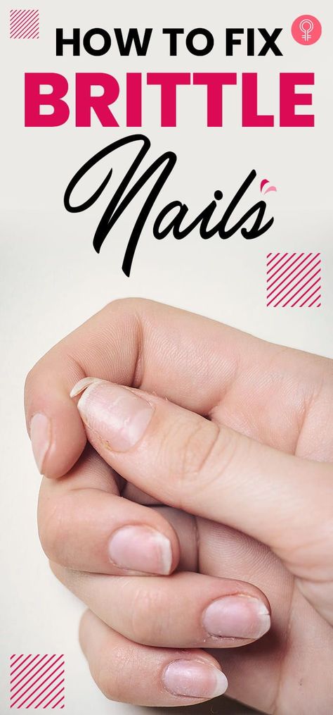 How To Fix Brittle Nails : it’s important to understand that sometimes brittle nails aren’t just something silly, it could be a sign of something serious too.From the minor to the most serious clues that nails give with regards to your body health, take a look below! #nailcare #brittlenails #nails Nail Remedies, Fungal Nail, Health Signs, Brown Spots On Face, Brittle Nails, New Nail Art, Nail Fungus, Nail Health, Healthy Nails