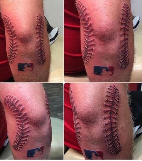 Baseball ball elbow scar tattoo Softball Tattoos, Baseball Tattoo, Baseball Tattoos, Sport Tattoos, Tattoos To Cover Scars, Stitch Tattoo, Scar Tattoo, Elements Tattoo, Bat Tattoo