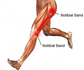 .org/2000/svg%22%20width=%22295%22%20height=%22246%22%3E%3C/ Iliotibial Band, It Band Stretches, Runners Knee, Hip Problems, Running Injuries, Hip Flexor Stretch, It Band, Knee Pain Relief, Foam Rolling