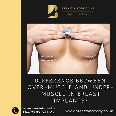 Under The Muscle Implants, Abdominal Pain Relief, Chest Muscles, Muscles, Surgery, Follow Us, Quick Saves, Beauty