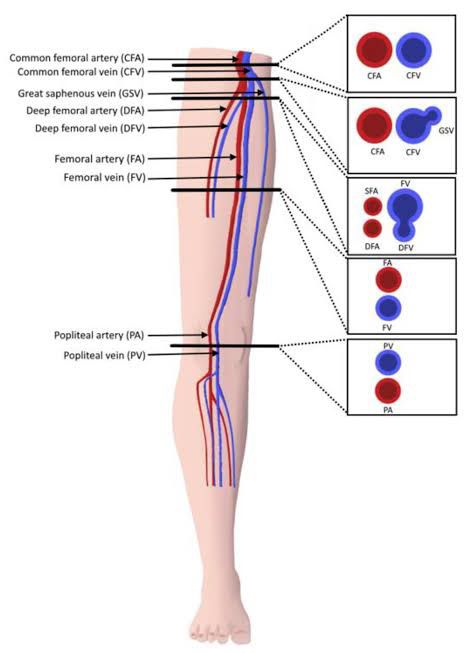 Lower Extremity Arterial Ultrasound, Vascular Sonography, Diagnostic Medical Sonography Student, Ultrasound School, Arteries Anatomy, Medical Radiography, Cardiac Sonography, Sonography Student, Vascular Ultrasound