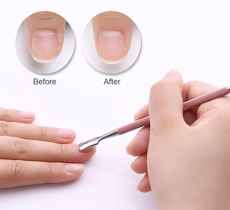 MUST have 1pc Stainless Steel Cuticle Remover/ Double Sided Finger Dead Skin Push - Pusher Cuticle Nail Pusher, Nail Glue Remover, Remove Acrylics, Nails Care, Polymer Clay Miniature, Remove Acrylic Nails, Nail Techniques, Cuticle Care, Colorful Nail Art