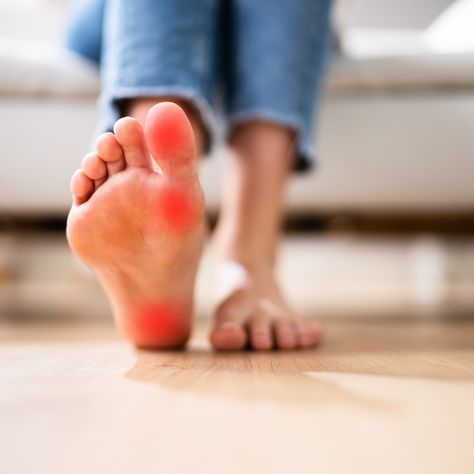 Whether it’s heel pain, arch pain, or any other foot issue, we’re dedicated to finding the root cause and providing effective solutions. Don’t let foot pain hold you back – schedule your appointment today and step into a pain-free life!   ☎️ 973-256-0002  #AdvancedFootCareNJ #PodiatristNJ #FootPain #PainRelief Heel Pain, Free Life, Foot Pain, Foot Care, Pain Free, Hold You, Pain Relief, Anatomy, Hold On