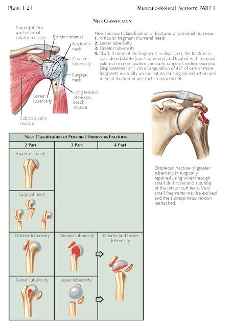 PROXIMAL HUMERAL FRACTURES   Neer Classification   Fractures of the proximal humerus are common, occur- ring most frequently in older pat... Humerus Fracture, Shoulder Anatomy, Rotator Cuff Tear, Daily Exercises, Healing Thoughts, Pinched Nerve, Musculoskeletal System, Medical School Studying, Rotator Cuff