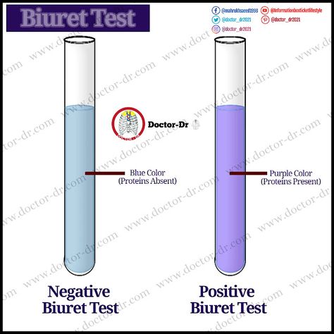 Principle, Procedure, Results, and Applications Microbiology Notes, Microbiology, Science