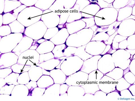 Adipose: Loose CT. Source of stored energy, thermal insulation, cushion. Highly vascular but capillaries have small dimensions compared to adipocytes. Loose Connective Tissue, Histology Slides, Medical Assistant Student, Integumentary System, Brown Adipose Tissue, Connective Tissue, Science Notes, Vet Med, Adipose Tissue