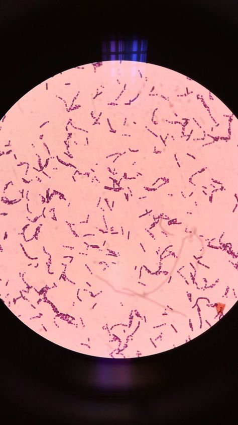 Bacteria under the microscope. Bacteria Microscope, Bacteria Under Microscope, Microscopic Bacteria, Gram Positive Bacteria, Microscope Images, Microbiology Lab, Study Biology, Under The Microscope, Science Rules