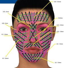 dermapen microneedling depth chart Dermapen Microneedling, Derma Rolling, Skin Needling, Derma Pen, Facial Aesthetics, Cosmetic Treatments, Derma Roller, Beauty Treatments, Facial Care