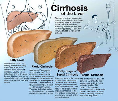 Gi Nursing, Diy Natural Detergent, General Medicine, Foot Reflexology Massage, Medical Nursing, Bells Palsy, Nursing School Essential, Gastrointestinal System, Basic Anatomy And Physiology