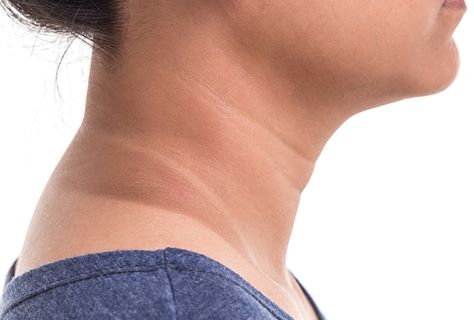 How to Get Rid of Dark Skin on Your Neck | Top 10 Home Remedies Dark Patches On Skin, Dark Neck, Acanthosis Nigricans, Lighten Skin Tone, When To Plant Vegetables, Top 10 Home Remedies, Neck Problems, Skin Patches, Black Neck