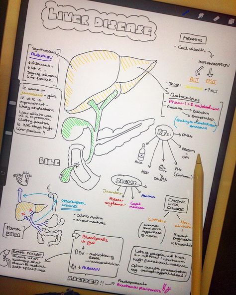 Using the iPad Pro to make quick notes in liver lectures this morning! A bit messy but so fun compared to my normal pencil and paper! #medicalstudent #medschool #medstudent #medicalschool #studyingmedicine #futuredoctor #liver #hepatology #anatomy #medicina #med #medlife #medicine #ipadpro #applepencil #procreate #ipadprodrawing Liver Notes, Ipad Pr, Medical Terminology Study, Medicine Notes, Study Biology, Medicine Studies, Medical Student Study, Nursing School Survival, Medical School Motivation