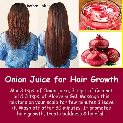 Hair Oil Massage, Onion Juice For Hair Growth, Juice For Hair Growth, Juice For Hair, Onion Benefits, Hair Oil For Hair Growth, Onion Hair Oil, Onion Juice For Hair, Onion Hair