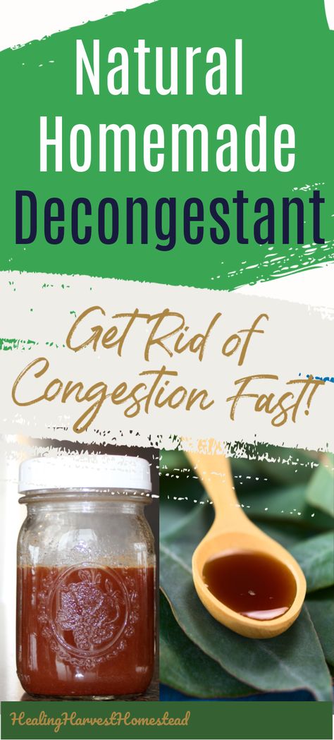 Homemade Decongestant, Congestion Remedies, Natural Decongestant, Herbal Remedies Recipes, Cold And Cough Remedies, Sick Remedies, Cold Sores Remedies, Natural Healing Remedies, Home Health Remedies