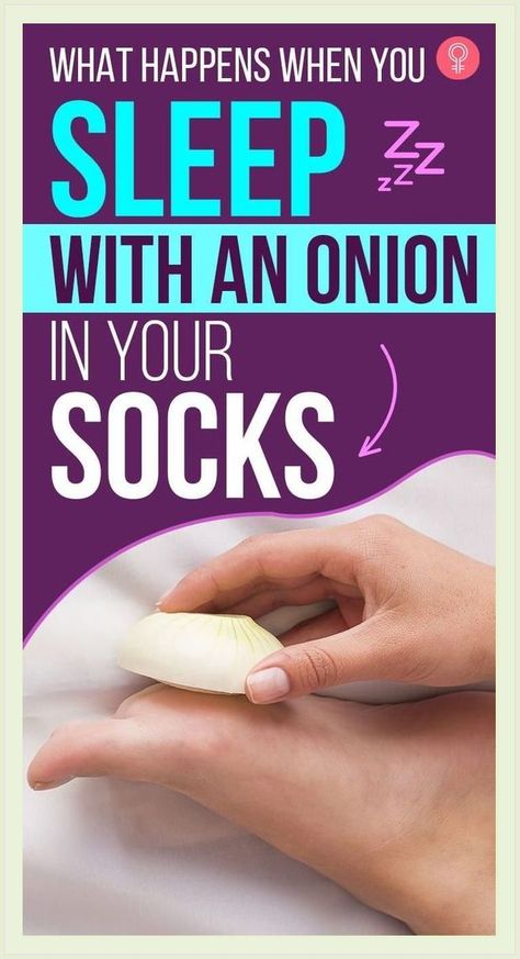 What Happens When You Sleep With an Onion in a Sock Onion In Sock, Onion In Your Sock, Best Cough Remedy, Sick Remedies, Benefits Of Sleep, Losing 40 Pounds, Home Remedy For Cough, Cold Sores Remedies, Natural Sleep Remedies