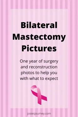 Radiation After Mastectomy, Double Mastectomy Without Reconstruction, Bilateral Mastectomy Tattoo, Brca2 Tattoo, Preventative Double Mastectomy, Mastectomy Cookies, Prophylactic Bilateral Mastectomy, Post Mastectomy Exercises, Mastectomy Recovery Must Haves