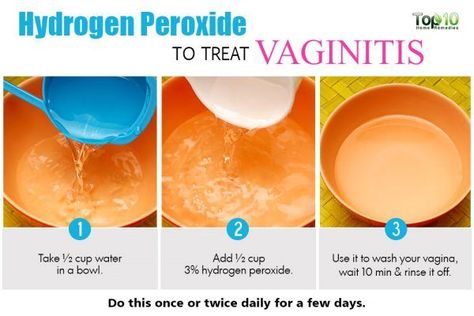 Bacteria Vaginosis, Feminine Odor, Treat Yeast Infection, Poo Poo, Top 10 Home Remedies, Yeast Infections, Women Health Care, Holistic Remedies, Hydrogen Peroxide