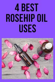 4 Best Rosehip Oil Uses Best Oils For Skin, Best Oil For Skin, Rosehip Oil Benefits, Baking Soda Benefits, Loss Hair, Natural Hair Mask, How To Grow Eyebrows, Aging Hair, Boost Hair Growth