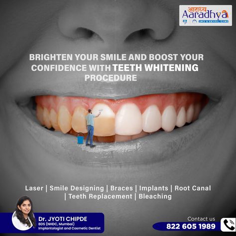 #dentalimplants #dentist #dentistry #dental #smile #teeth #dentalcare #dentalclini #oralhealth #aaradhyadentalcare Dental Implants Creative Ads, Dental Creative Ads, Toothache Remedies, Dentist Design, Dental Post, Dental Ads, Dental Advertising, Dental Social Media, Teeth Whitening Procedure