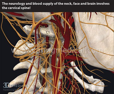 The cervical spine is intertwined with nerves and blood vessels. Cervical spine instability can compress or pinch the nerves and arteries causing a myriad of symptoms depending on how the patients moves his/her head. Cervical Lordosis, Vertebral Artery, Neck Problems, Elbow Pain, Musculoskeletal Pain, Cervical Spine, Spine Surgery, Stem Cell Therapy, Vagus Nerve