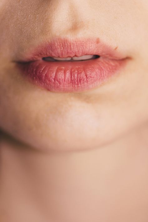 Lips tend to become easily chapped because they don’t contain oil or sweat glands like the rest of your body. Learn more about chemical lip peels. Abdominal Stretches, Lips Peeling, Moon Lee, Skin Bumps, Sweat Gland, Lip Exfoliator, Smooth Lips, Exfoliate Face, Chemical Peel