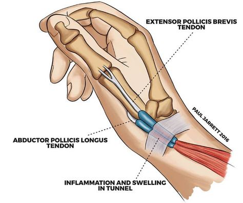 Wrist Pain Relief, Wrist Exercises, Human Body Anatomy, Muscular System, Hand Therapy, Thai Massage, At Home Exercises, Medical Education, Flexibility Workout