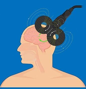 Investigating Working Memory Protection using Transcranial Magnetic Stimulation (TMS) - Centre for Integrative Neuroscience and Neurodynamics Transcranial Magnetic Stimulation, University Of Reading, Magnetic Resonance Imaging, Working Memory, Magnetic Resonance, Research Studies, Data Collection, Neuroscience, Biology