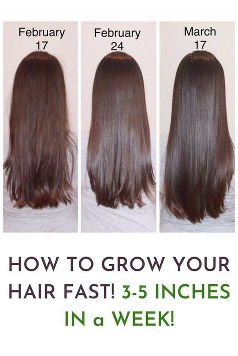 hair growth tips haircare haircare tips aesthetic hair hair tips hair growth oil grow hair faster      
hair growth tips how to grow your hair faster haircare hair growth hair tips hair mask hair care Long Hair Shampoo, Grow Your Hair Faster, Quick Hair Growth, Increase Hair Volume, Hair Fall Solution, Hair Growth Foods, Thicker Fuller Hair, Increase Hair Growth, How To Grow Your Hair Faster